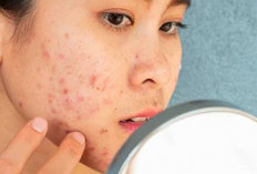 Apa Itu Skinbarrier, Penyebab dan Tips Memperbaiki Skinbarier  Dengan Cepat  