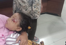 Korban Serangan Anjing Liar, Balita di Arma Jaya Jalani Perawatan Intensif