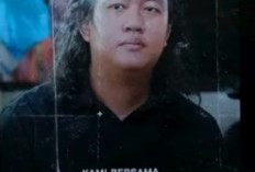 Kondisi Terkini Andrie Yunus,  Aktivis KontraS  Jalani Operasi Mata Terpadu Usai Disiram Air Keras