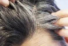 Rambut Beruban Di usia Muda! Kenali Penyebab dan Cara Mengatasinya 