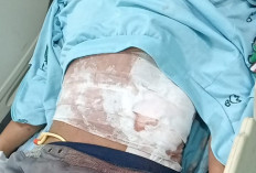 Perut Ditusuk, Handphone Dicuri, Nasib Korban Begal di Kawasan Lapangan Golf Bengkulu