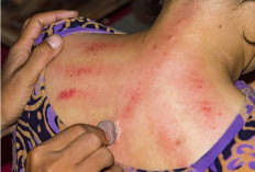  Belum Banyak Yang Tahu, Jangan Mengerok di  5 Bagian Tubuh Ini, Bahayanya Begini 