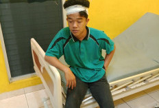 Dibacok OTD, Kepala Pelajar di Kepahiang Bocor