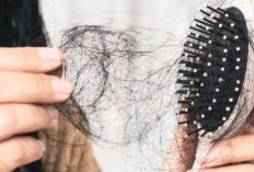 Rambut Anda Rontok, Ini Tips Alami untuk Mengatasinya