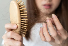 Atasi Kebotakan, Berikut Tiga Cara Alami   Atasi Rambut Rontok 