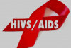 5 Warga Lebong Terpapar HIV, Dinkes Ingatkan Ini Penyebabnya